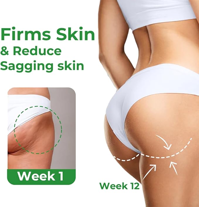 Artemis Lift Cream